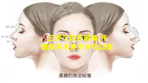 三岁可以开眼角 开眼角手术多少岁可以做